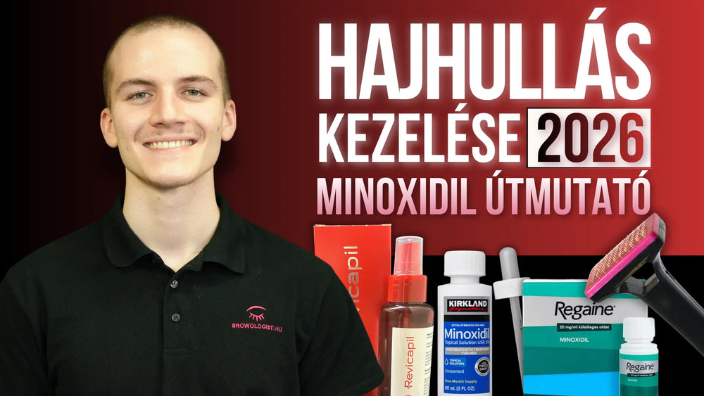 Minoxidil útmutató – Használat, ár, mellékhatások, eredmények