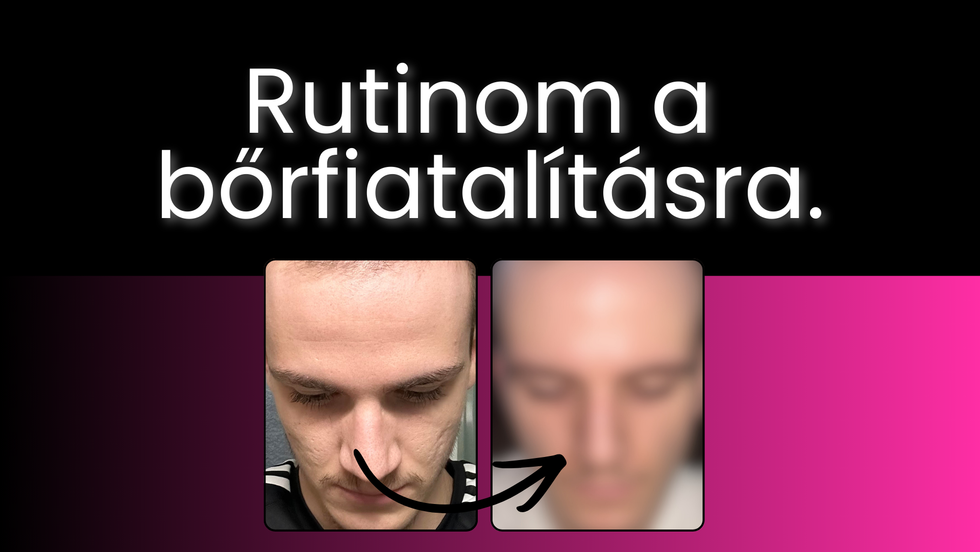 Arcfiatalítás, bőrmegújítás saját tapasztalaton keresztül