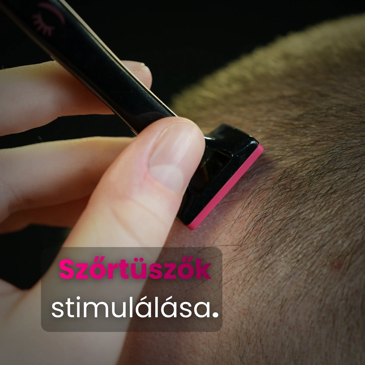 Szőrtüszők stimulálása 2