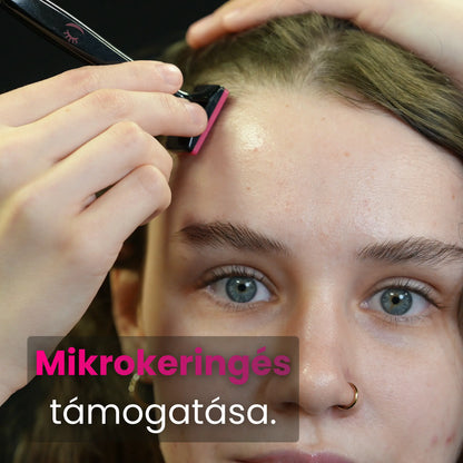 Mikrokeringés támogatása